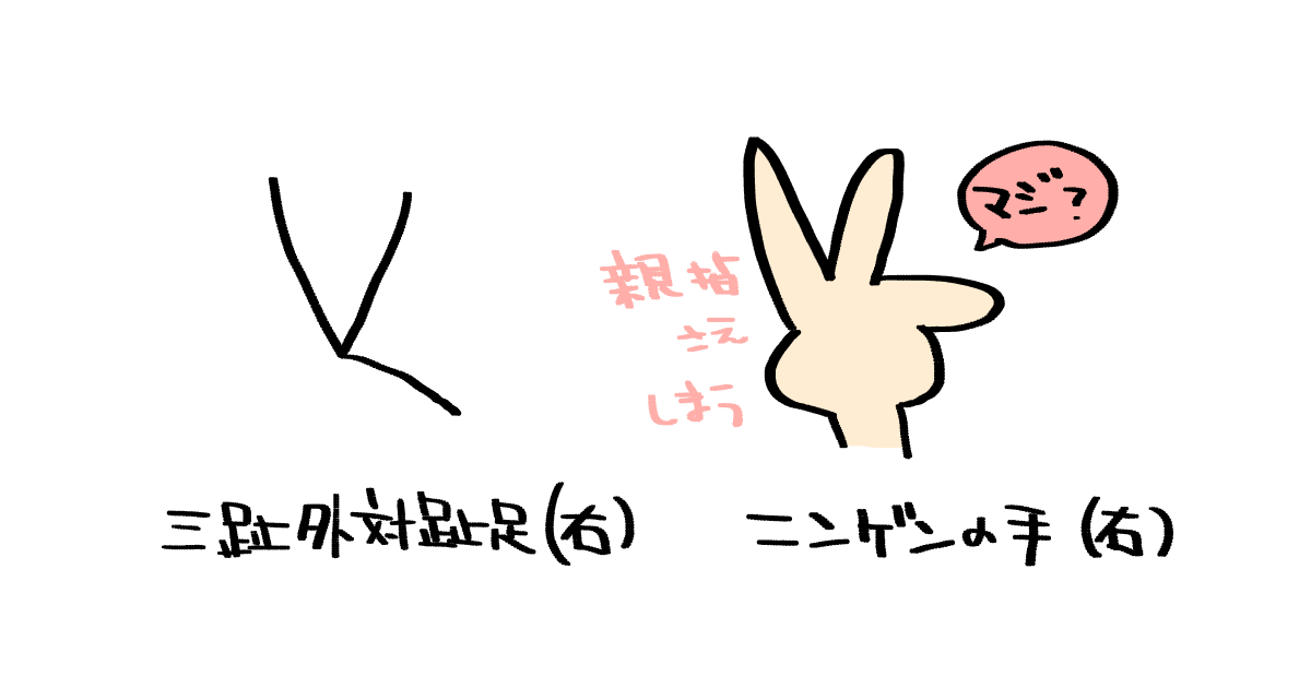 三趾外対趾足